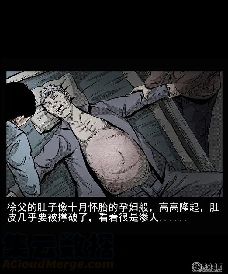 66 赤脚医生破蛊（上）20