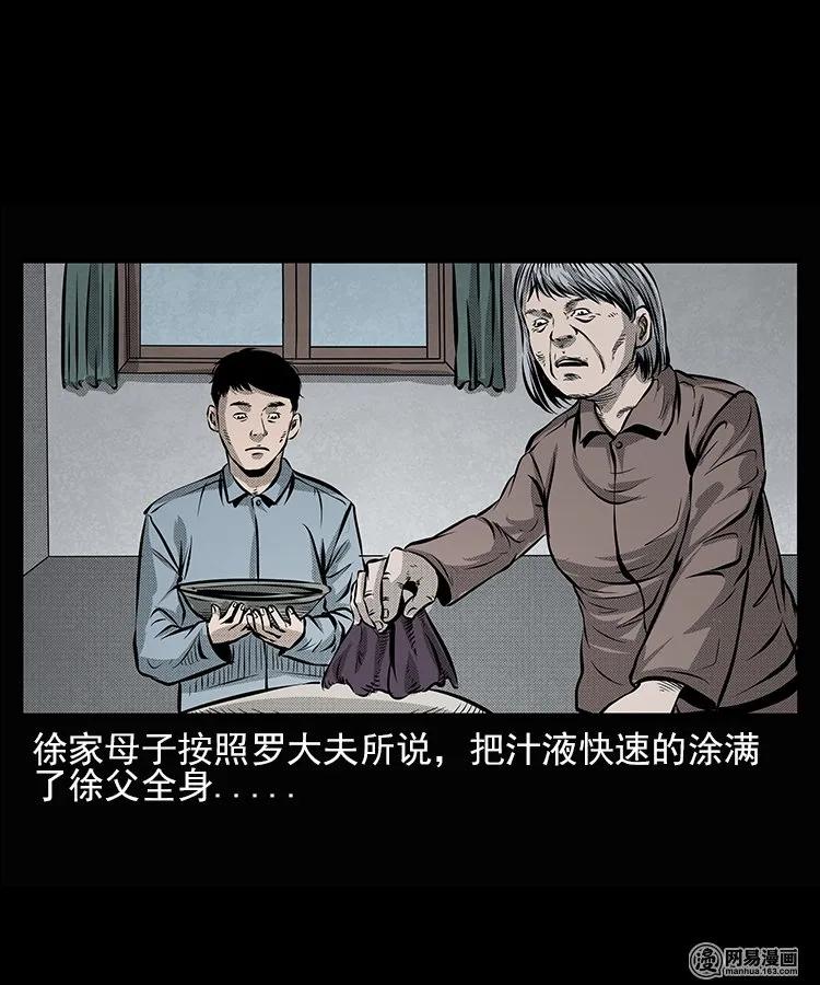 67 赤脚医生破蛊（下）31