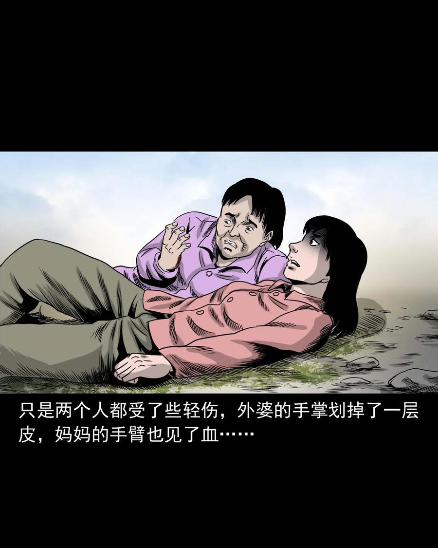 335 额头上的疤42