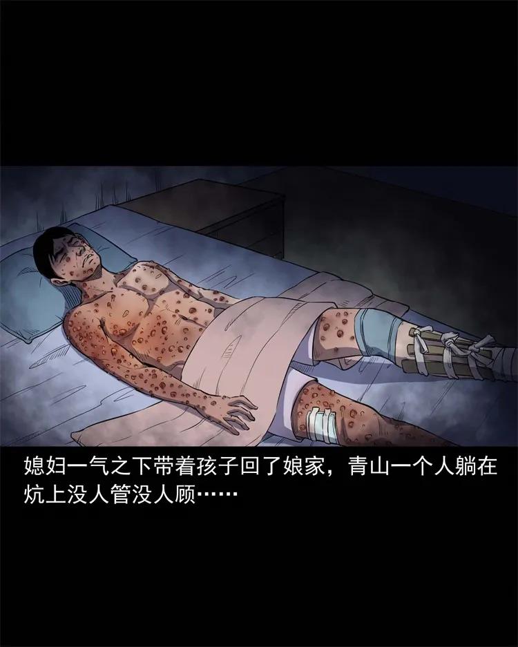 254 瘟神26