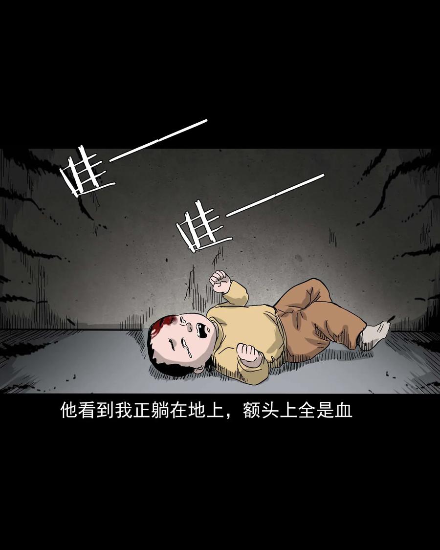 335 额头上的疤66