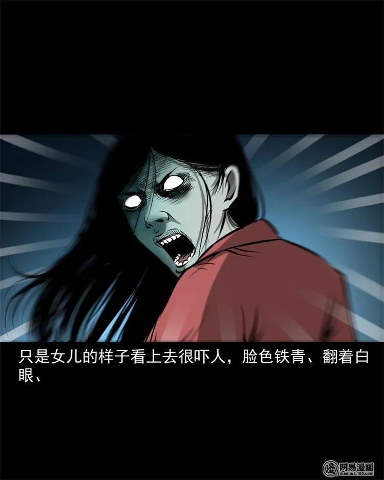 217 并骨70