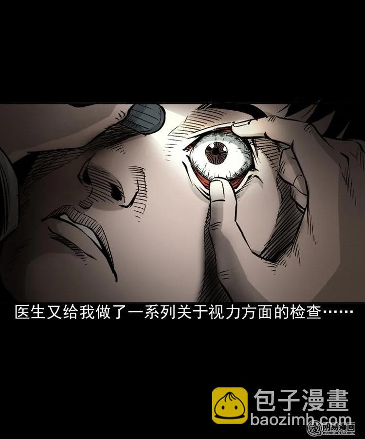 151 阴阳眼（一）26
