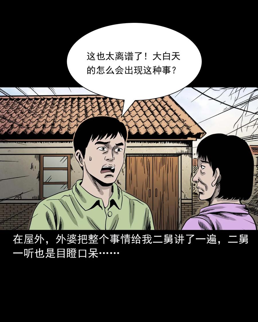 335 额头上的疤59