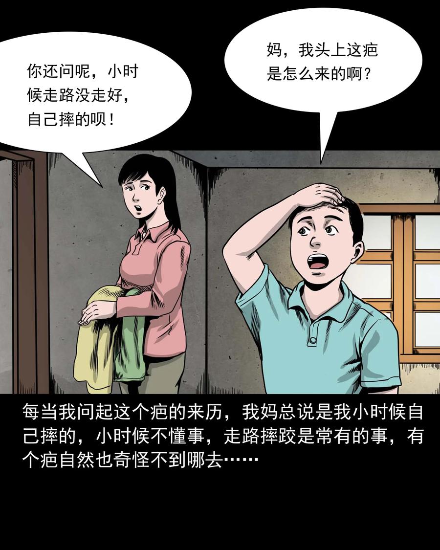 335 额头上的疤2