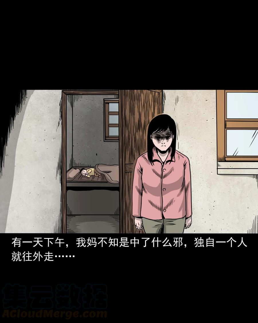 335 额头上的疤20