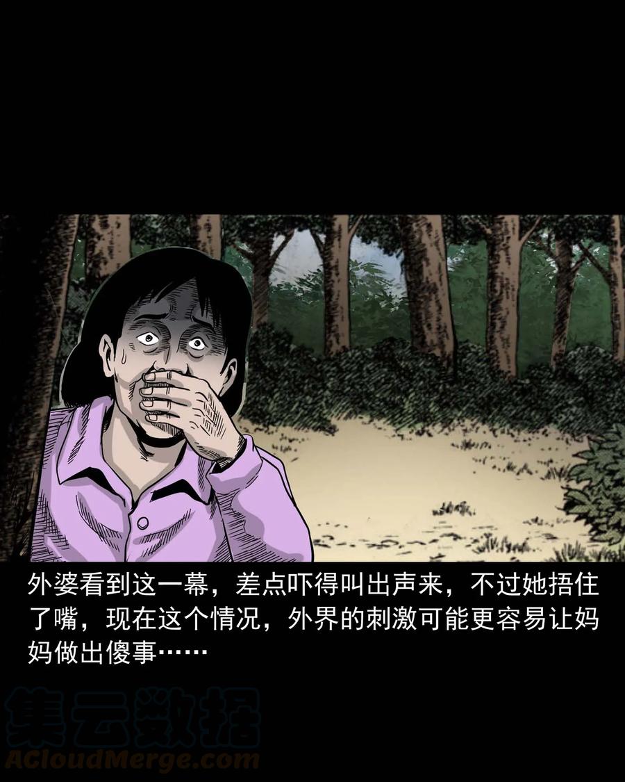 335 额头上的疤36