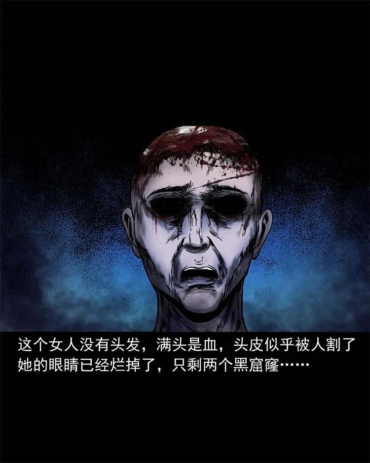 256 血发22