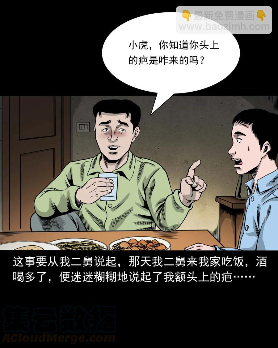 335 额头上的疤8