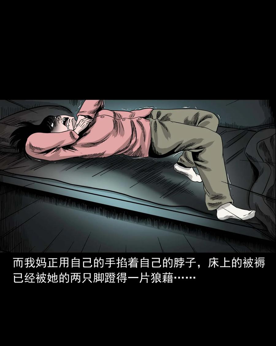 335 额头上的疤67