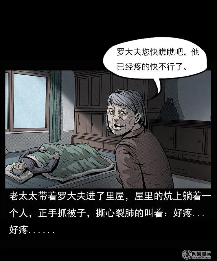 66 赤脚医生破蛊（上）9