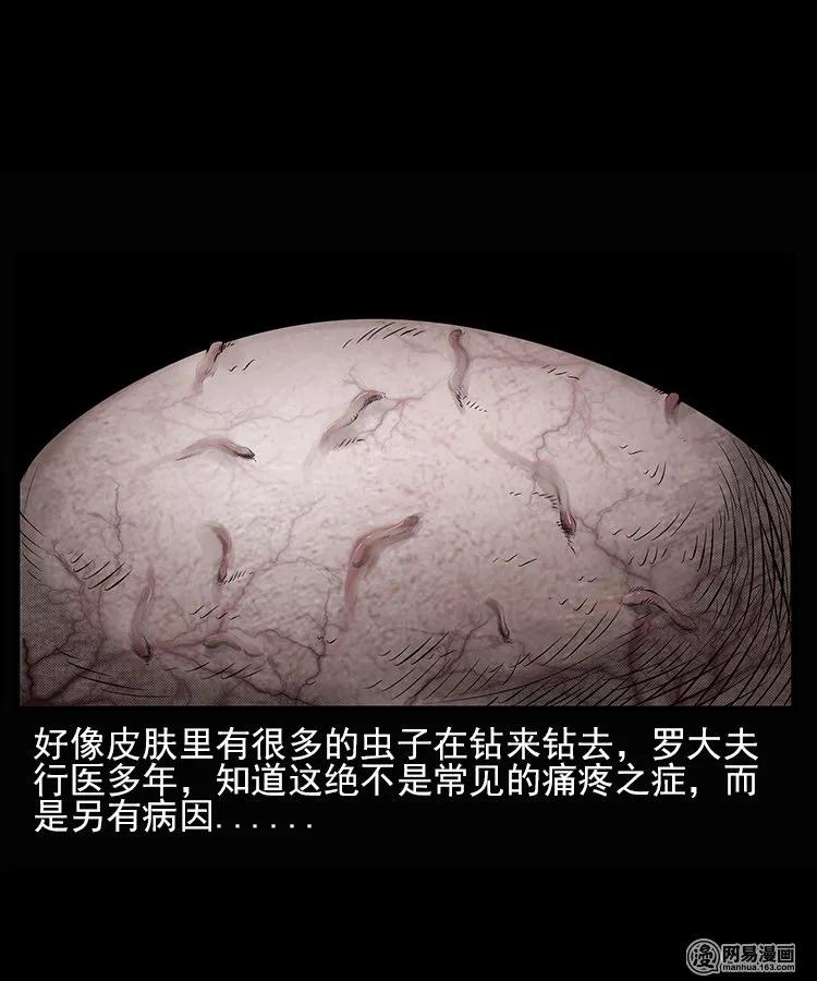 66 赤脚医生破蛊（上）22