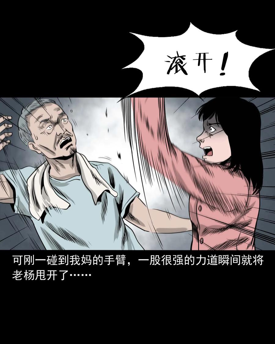 335 额头上的疤25