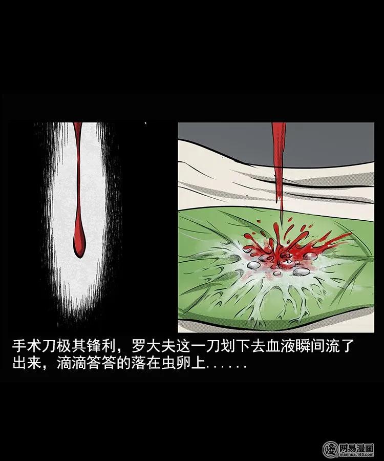 67 赤脚医生破蛊（下）11