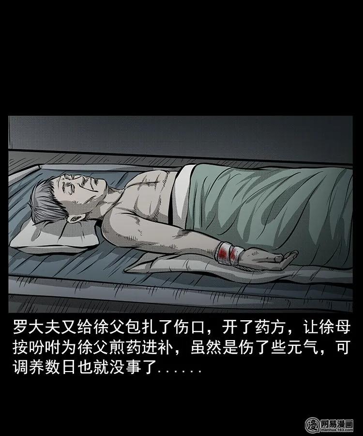 67 赤脚医生破蛊（下）50
