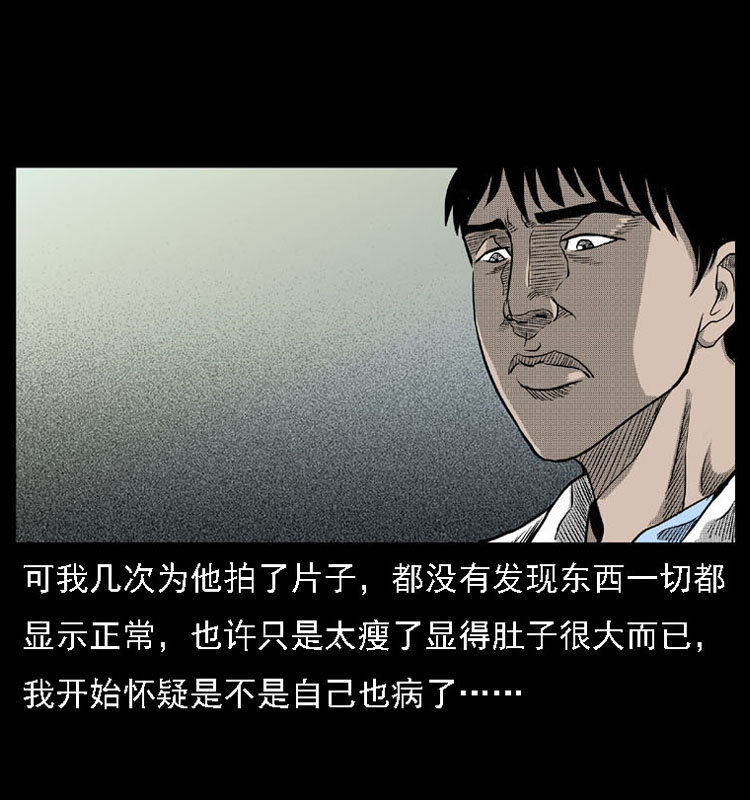 18 寄生物58