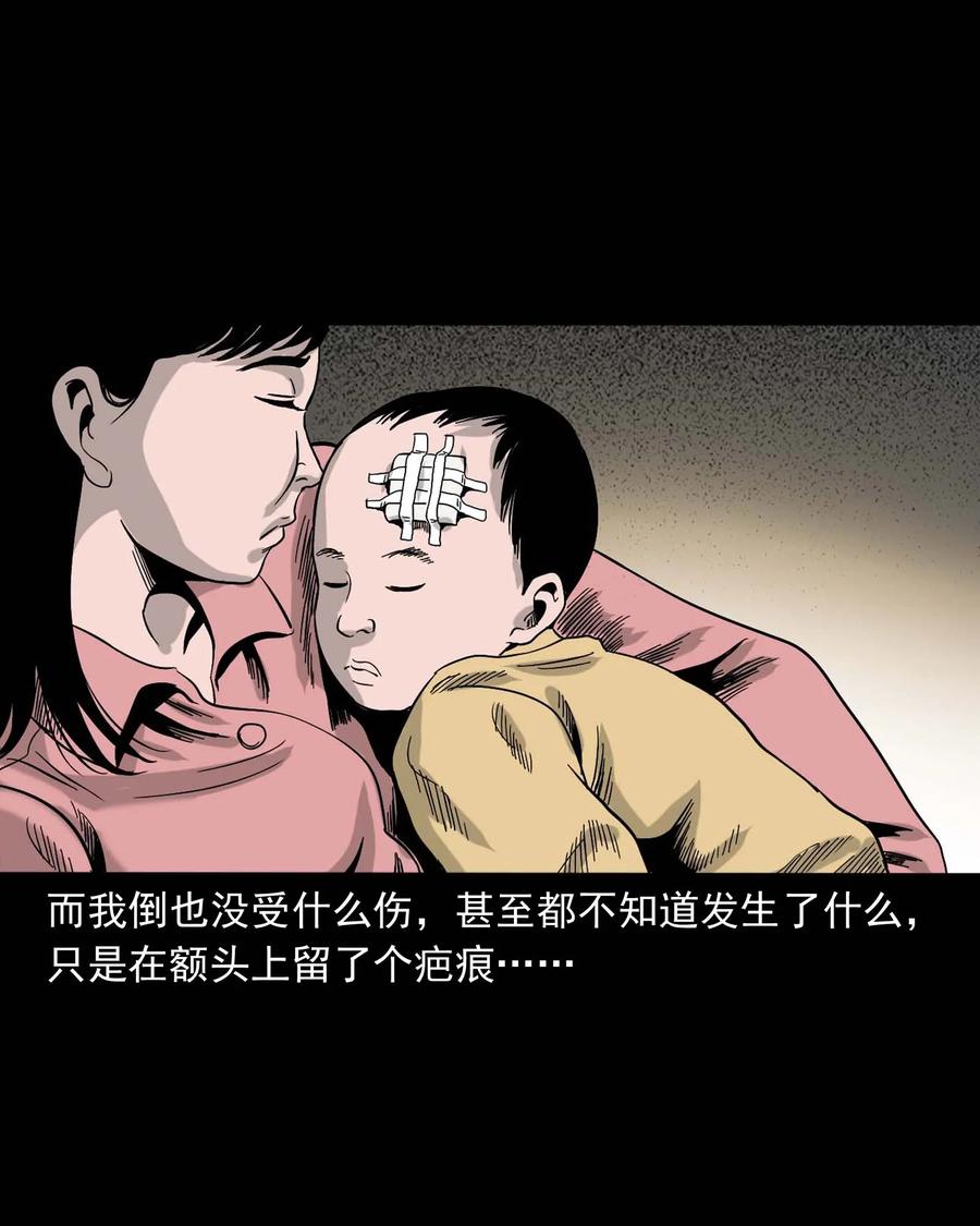 335 额头上的疤89