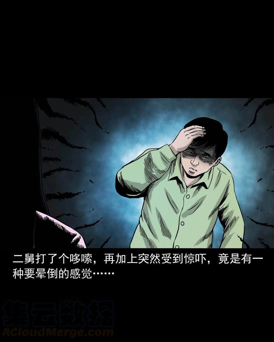 335 额头上的疤80