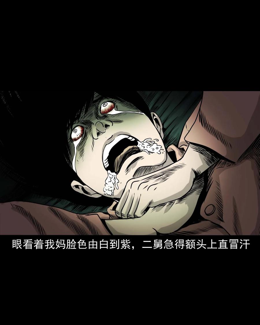 335 额头上的疤70