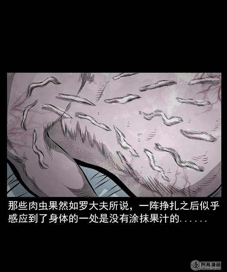 67 赤脚医生破蛊（下）39