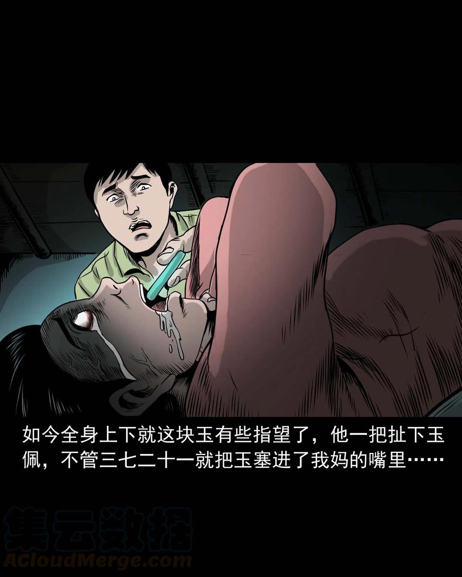 335 额头上的疤72