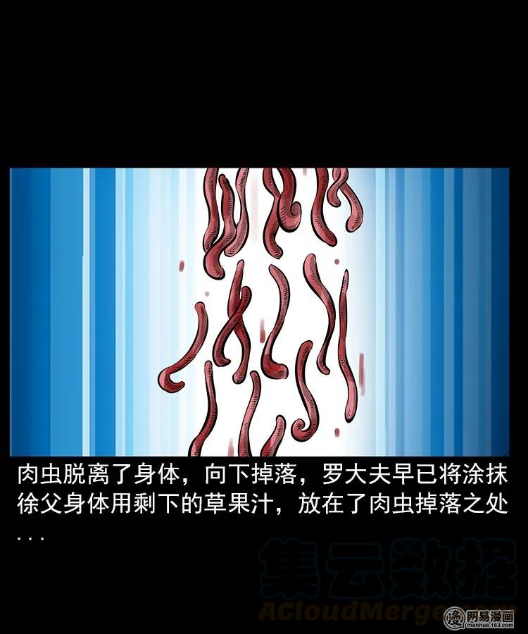 67 赤脚医生破蛊（下）44