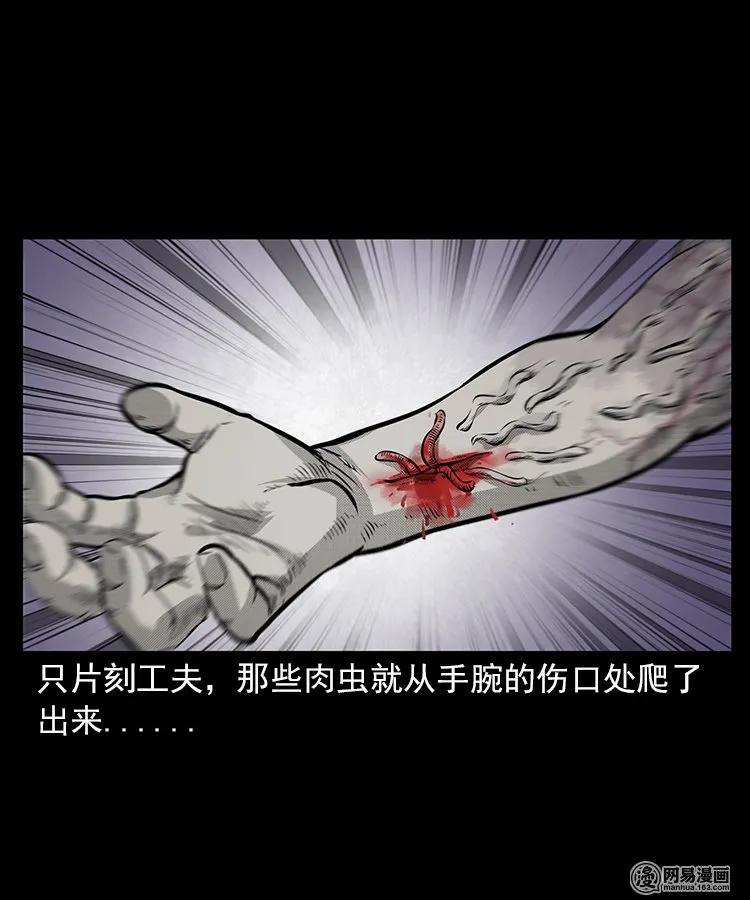 67 赤脚医生破蛊（下）41