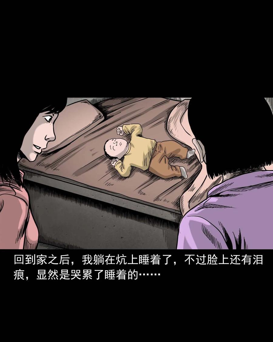 335 额头上的疤45