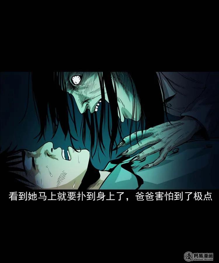 178 发夹31