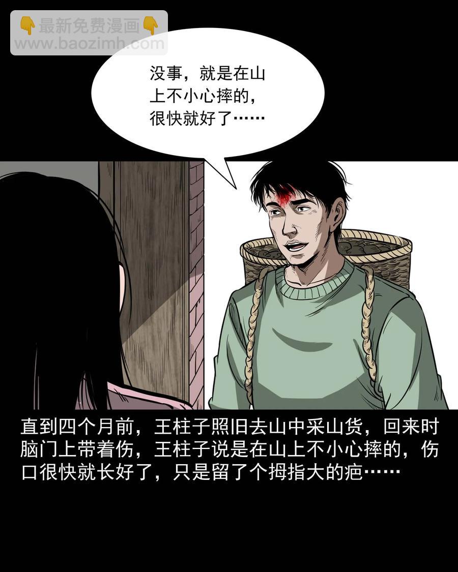 313 疯病23