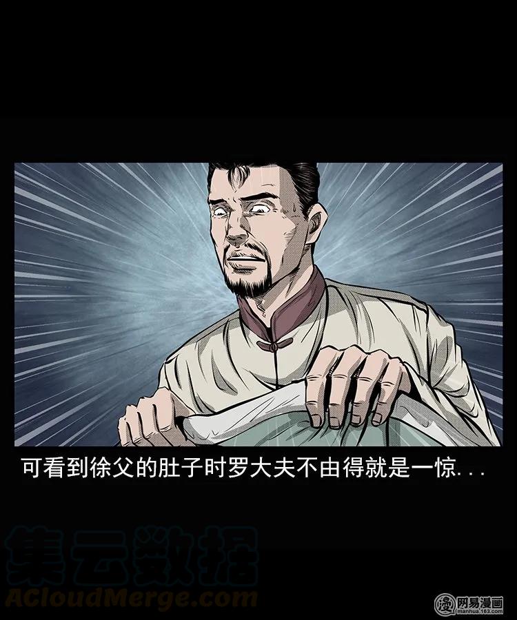 66 赤脚医生破蛊（上）16