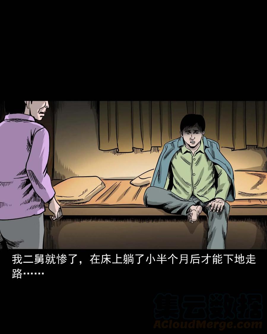 335 额头上的疤88