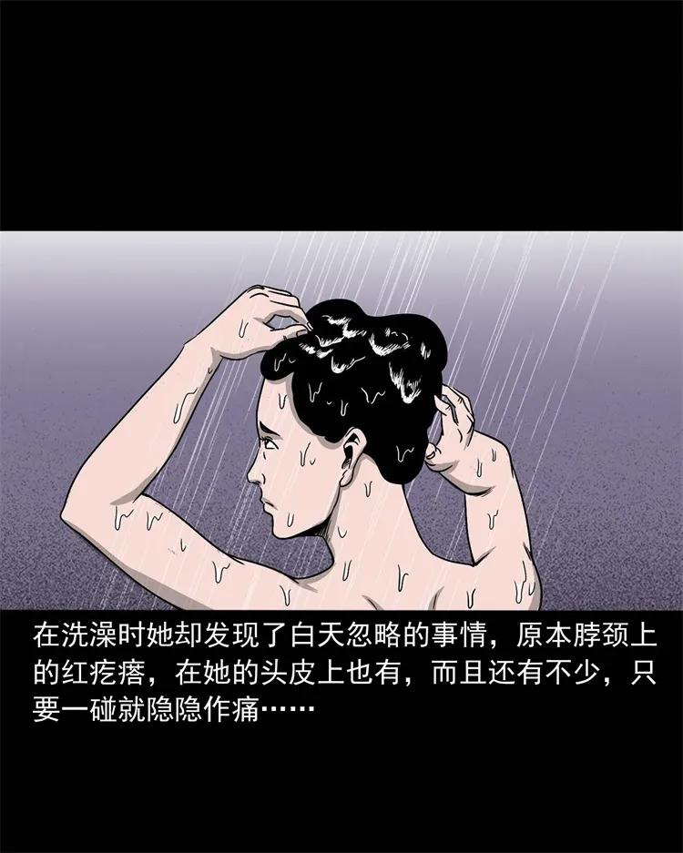 256 血发15