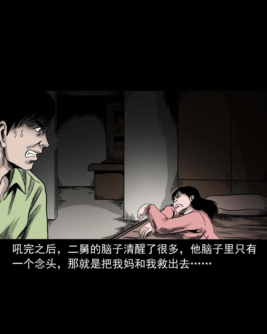 335 额头上的疤82