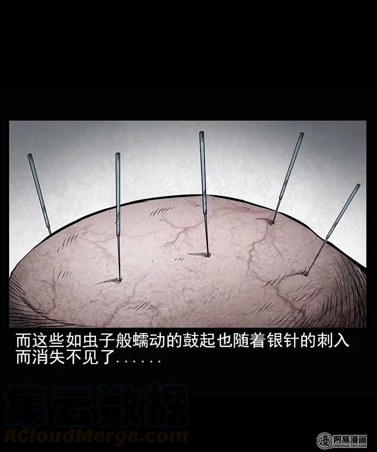 66 赤脚医生破蛊（上）28
