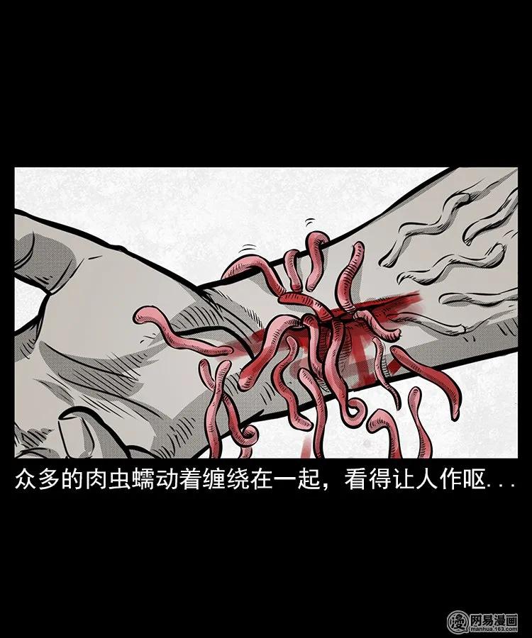 67 赤脚医生破蛊（下）43