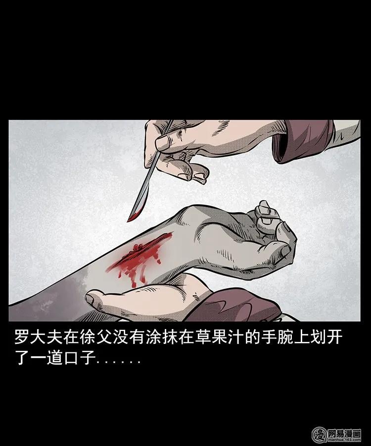 67 赤脚医生破蛊（下）34