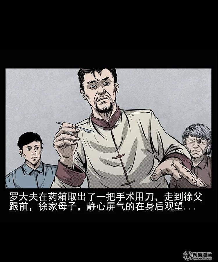 67 赤脚医生破蛊（下）33