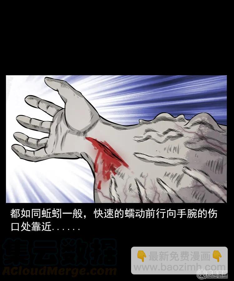 67 赤脚医生破蛊（下）40