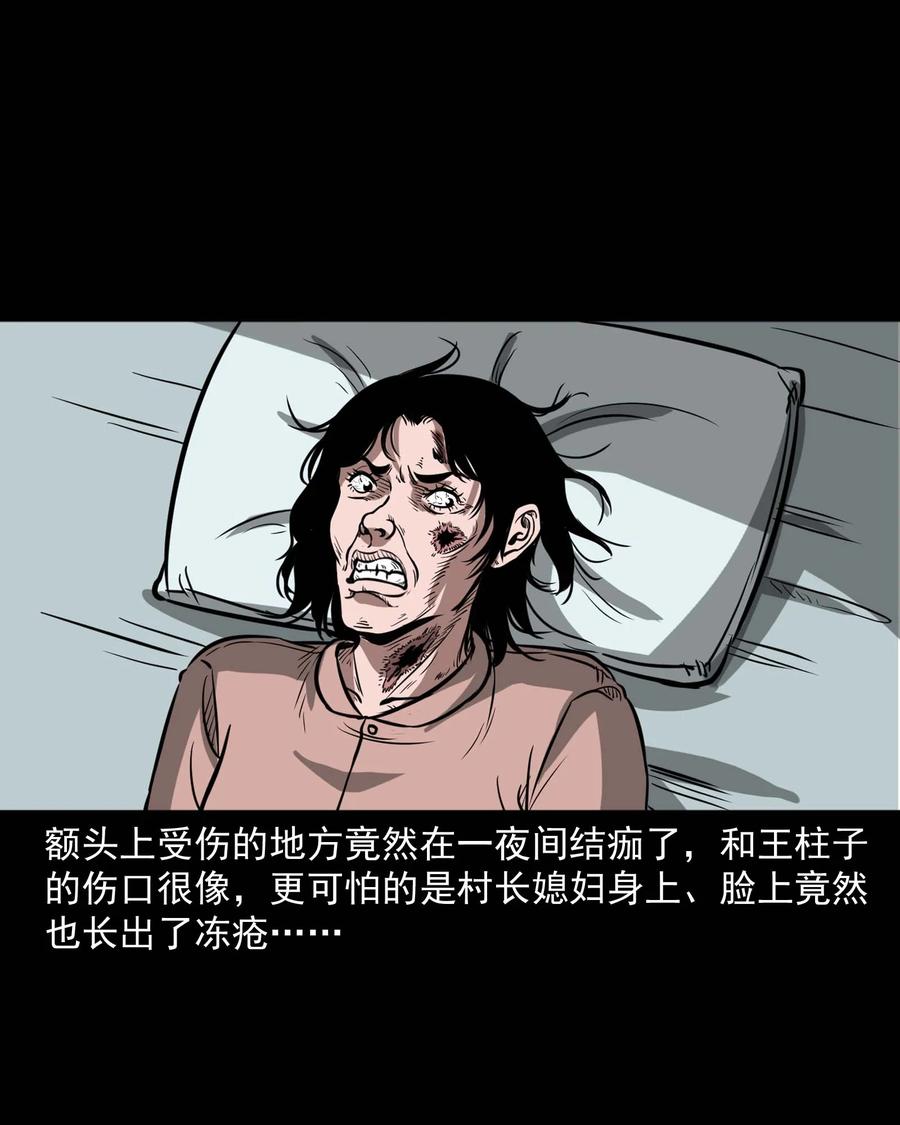 313 疯病67