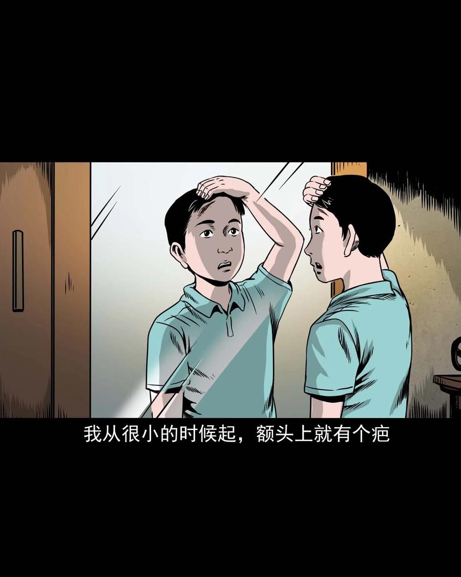 335 额头上的疤1