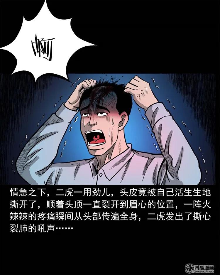 230 梦中脱皮26