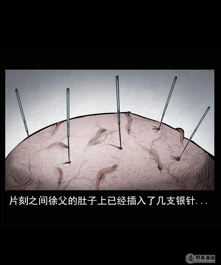 66 赤脚医生破蛊（上）27