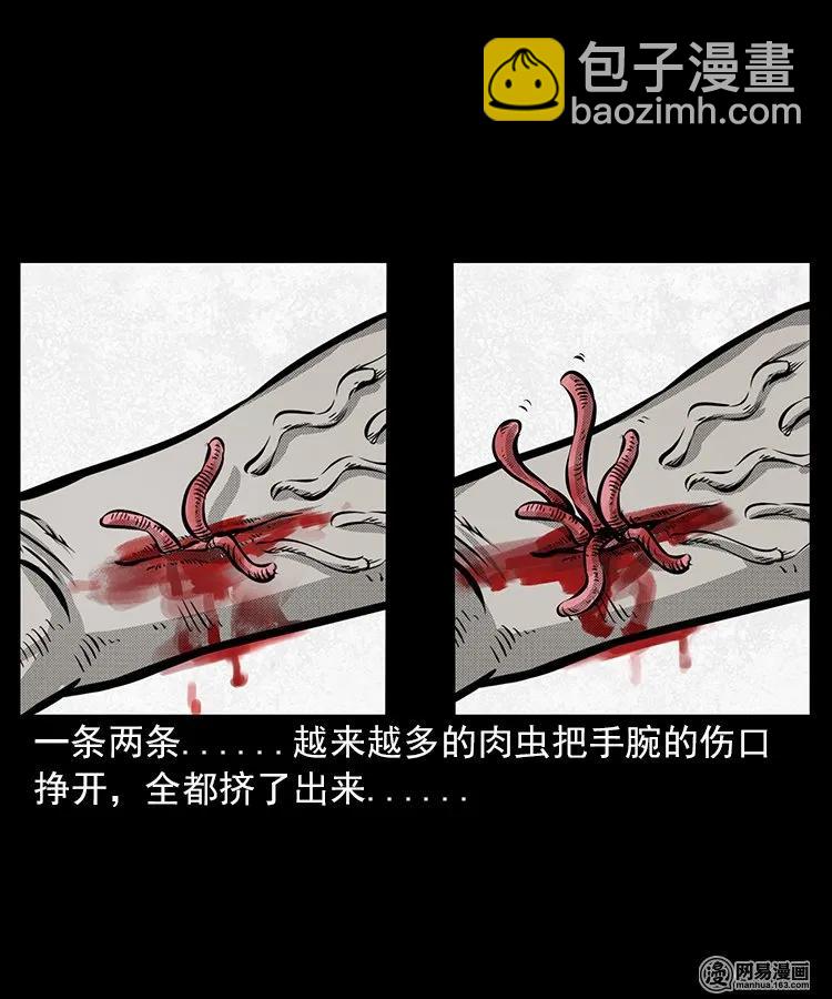 67 赤脚医生破蛊（下）42