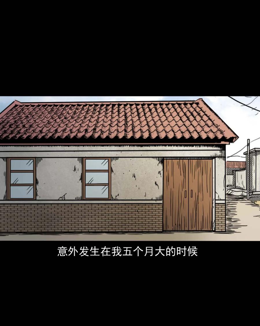 335 额头上的疤19