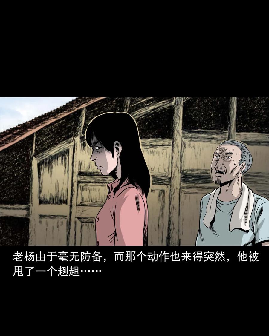 335 额头上的疤26