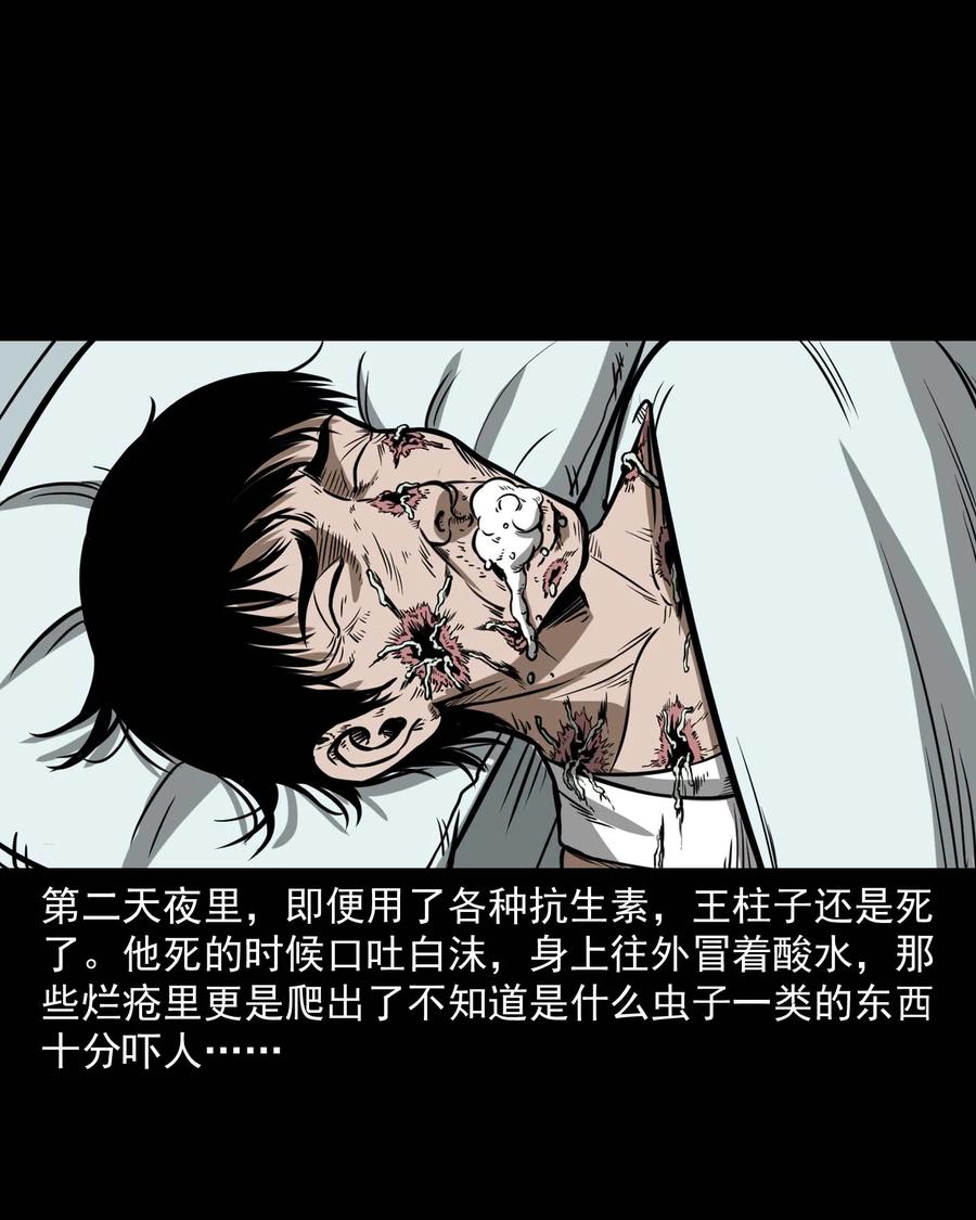 313 疯病46