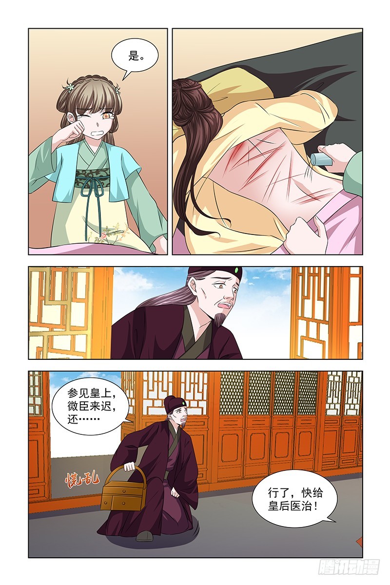 050 快给皇后医治2