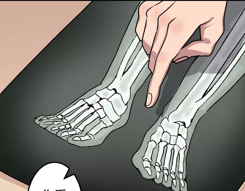 第9话 别人的腿7