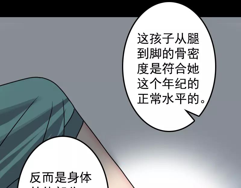第9话 别人的腿14